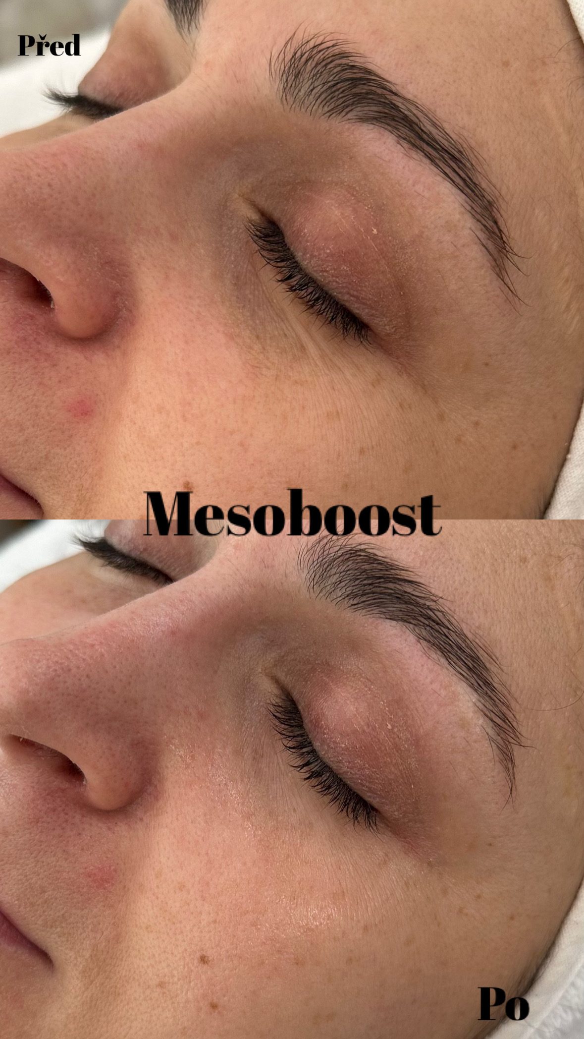 MesoBoost – fotografie 2